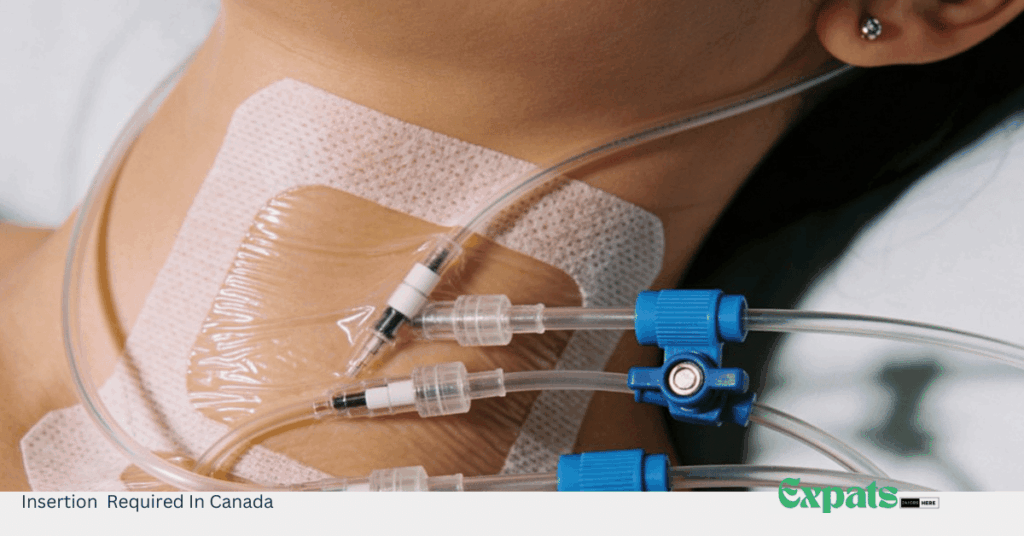 Insertion Required In Canada